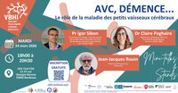 Soirée AVC et démence : prévention, science et échanges à Bordeaux